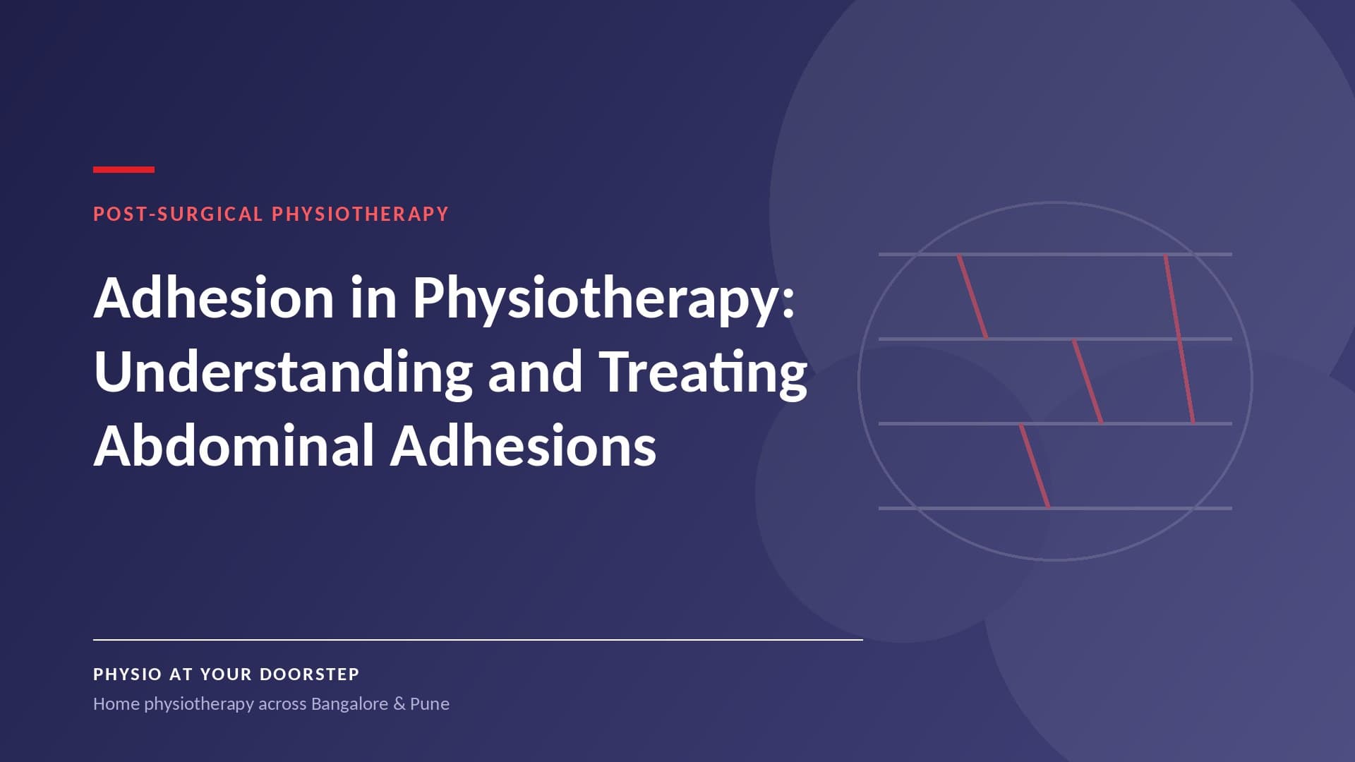 Adhesion in Physiotherapy: A Complete Guide to Understanding and Treating Abdominal Adhesions