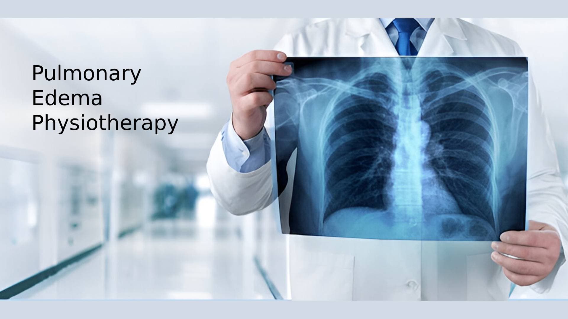 Pulmonary Edema Physiotherapy: Complete Recovery Guide